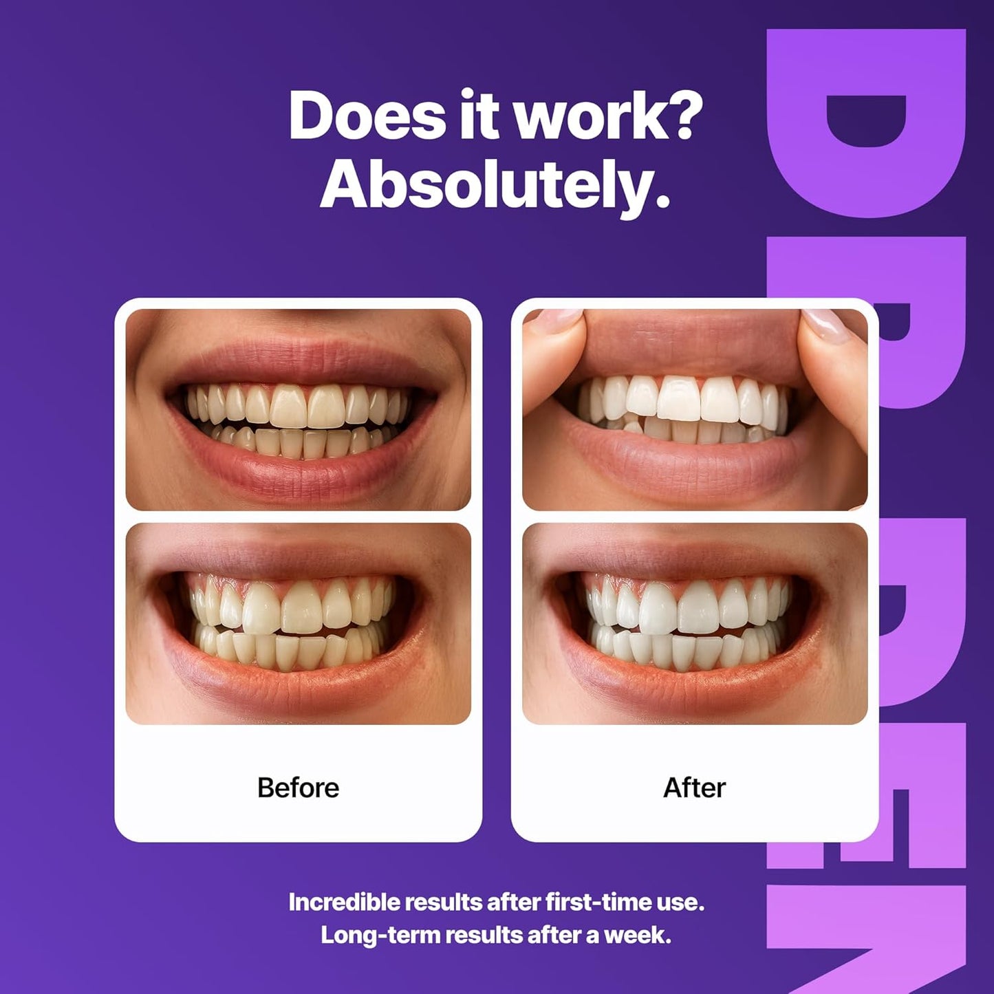 Radiant Smile Whitening Strips